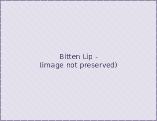 Bitten Lip -